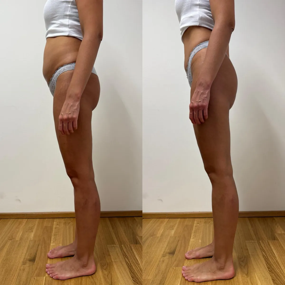 Körpervergleich von Bauch, Hüfte und Beinen in Seitenansicht