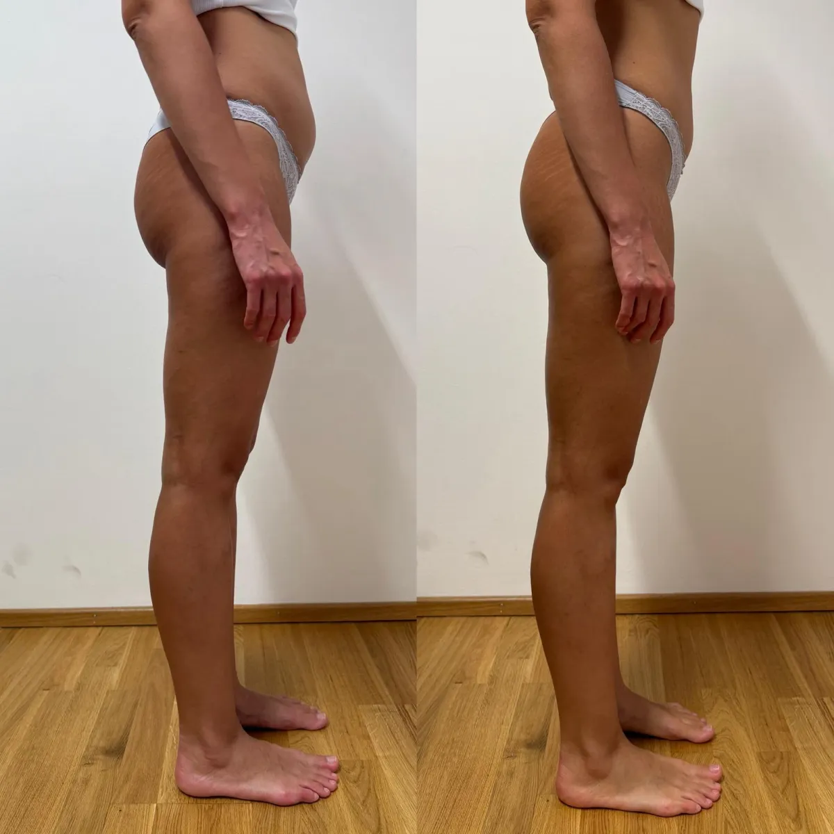 Körpervergleich von Bauch, Hüfte und Beinen in der gegenüberliegenden Seitenansicht