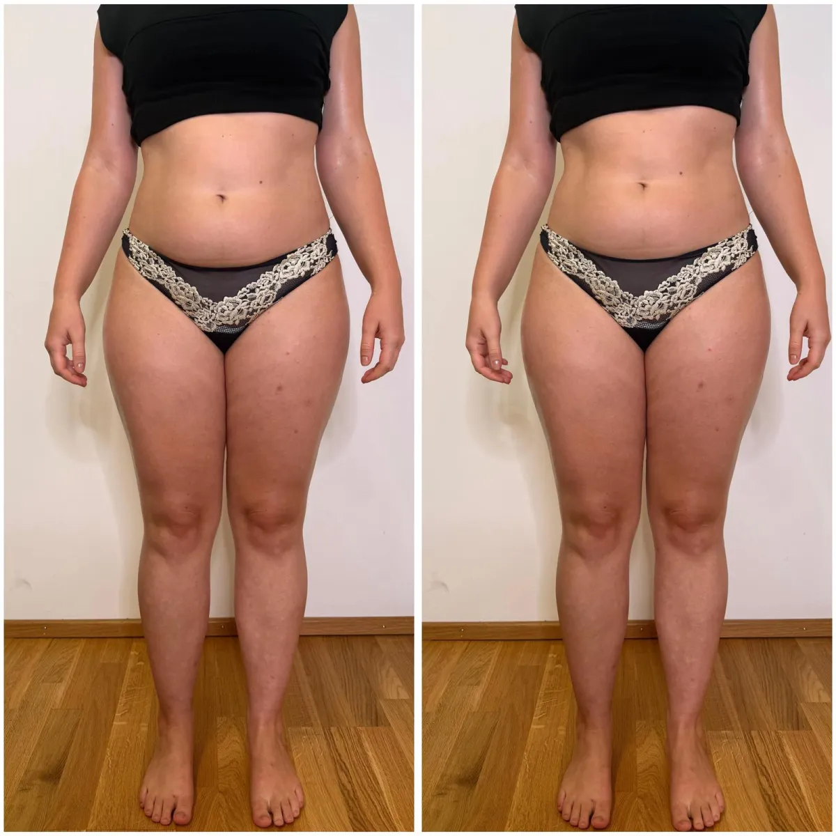 Körpervergleich von Bauch, Hüfte und Beinen in einer weiteren Vorderansicht