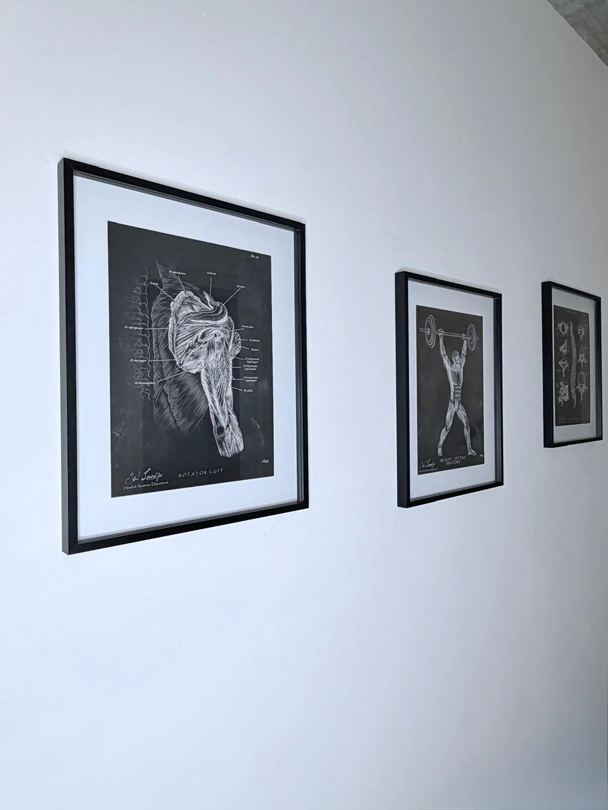 Schwarz-weiße anatomische Illustrationen an einer weißen Wand
